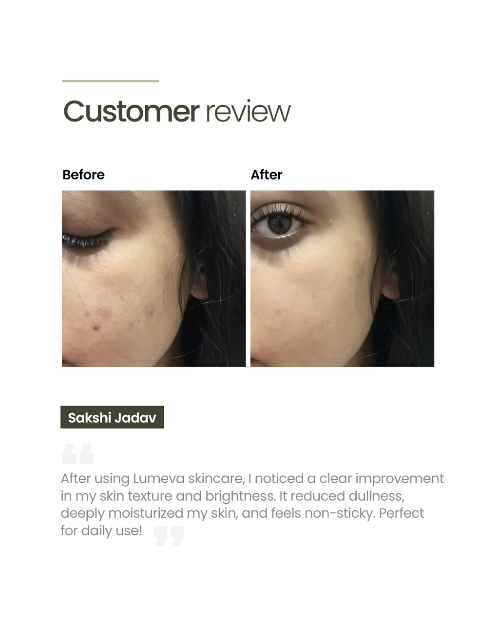 Donkey Milk Face Serum