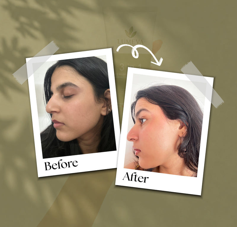 Before and after comparison of a woman's face on a green background with 'Lumea' branding.