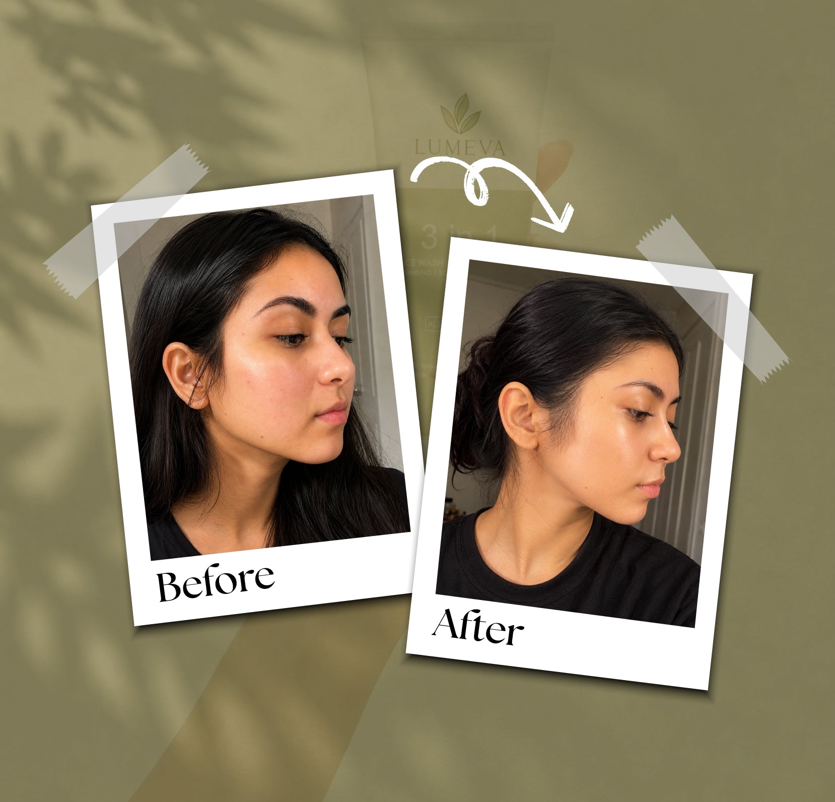Before and after comparison of a woman on a green background with 'Lumeva' branding.