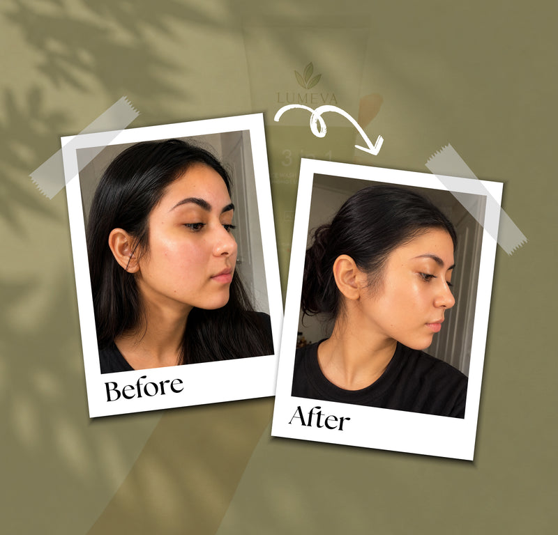 Before and after comparison of a woman on a green background with 'Lumeva' branding.